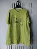 fes heart TEE